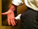 thumb